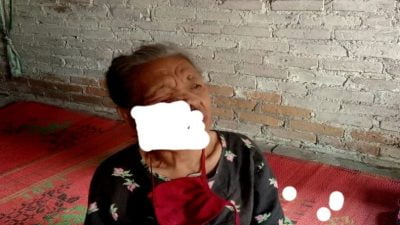 Nenek Muriati Menderita Penyakit Benjolan dan Keroak Diwajah,Butuh Uluran Tangan