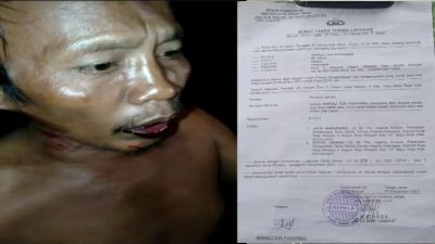 Polsek Kota Tanah Jawa Diminta Tangkap Komplotan Preman Pelaku Penganiayaan Terhadap Maruli Pasaribu di Simalungun