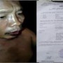 Teks Foto : Korban pengeroyokan dan Bukti laporan ke Polsek