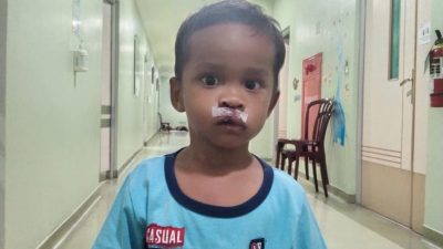Berkat kepedulian IPTU Suheri sitorus nahum sinaga bisa tersenyum seperti anak se usianya
