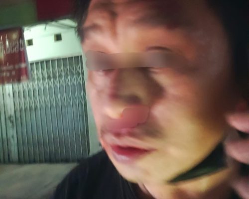 Miris, Korban penyerangan dan Pengeroyokan di Jadikan Tersangka, Terlapor Berkeliaran