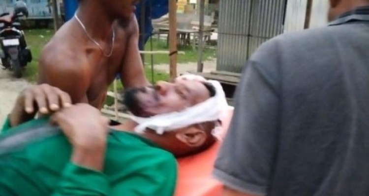 Pekerja HTI di Pelalawan Diserang Harimau Sumatera, Mengalami Luka Serius di Kepala