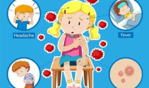 WHO Tetapkan Mpox sebagai Kedaruratan