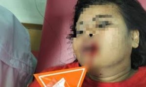Perkelahian Mematikan: Hutang Jadi Pemicu Penganiayaan