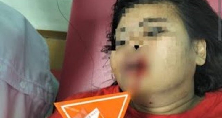 Perkelahian Mematikan: Hutang Jadi Pemicu Penganiayaan