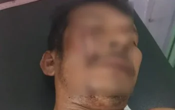 Wartawan dan Polisi Diserang