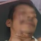 Wartawan dan Polisi Diserang