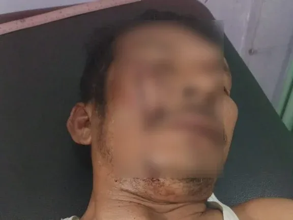 Wartawan dan Polisi Diserang