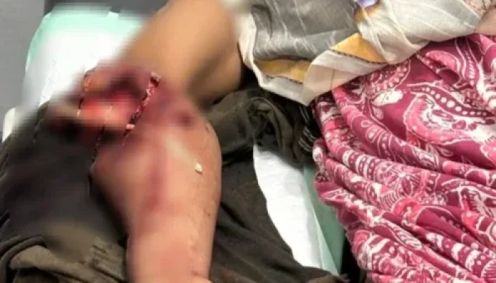 Buaya Sungai Rokan Kembali Menyerang, Pekerja Sawit Asal Tanah Putih Jadi Korban