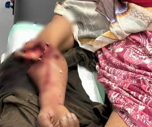 Buaya Sungai Rokan Kembali Menyerang, Pekerja Sawit Asal Tanah Putih Jadi Korban