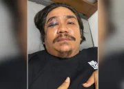 Sempat Jadi Korban, Pria di Mandau Bengkalis Ini Justru Ditetapkan Polisi Jadi Tersangka