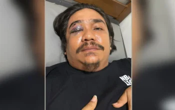 Sempat Jadi Korban, Pria di Mandau Bengkalis Ini Justru Ditetapkan Polisi Jadi Tersangka