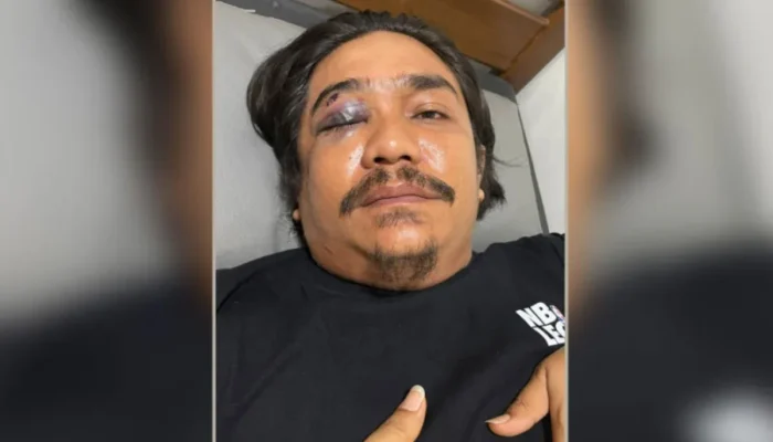 Sempat Jadi Korban, Pria di Mandau Bengkalis Ini Justru Ditetapkan Polisi Jadi Tersangka