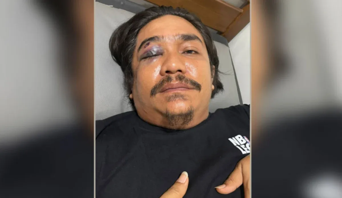 Korban Penganiayaan di Mandau Bengkalis Jadi Tersangk
